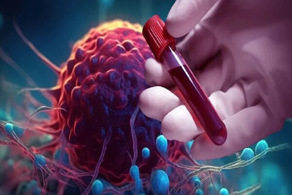 कैंसर से बचना है, तो घर से निकाल दें ये चीजें… डॉक्टर ने दी बड़ी चेतावनी!