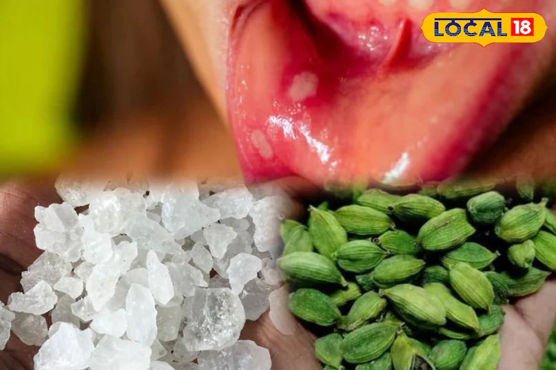 दादी-नानी का देसी नुस्खा! मिश्री और इलायची से ऐसे बनाएं पेस्ट, मुंह के छालों में मिलेगा आराम
