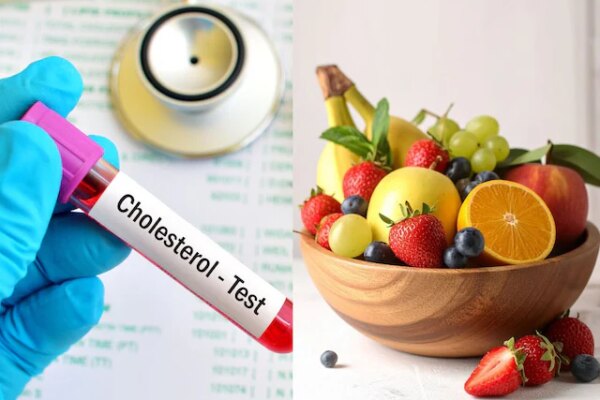 कोलेस्ट्रॉल के मरीजों के लिए दवा से कम नहीं ये 5 फ्रूट्स ! नसों में जमी गंदगी कर देंगे बाहर, फायदे बेमिसाल