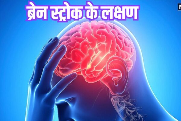 स्ट्रोक के लक्षणों को न करें नजरअंदाज, ‘बचाव’ फॉर्मूला से बनेगी बात