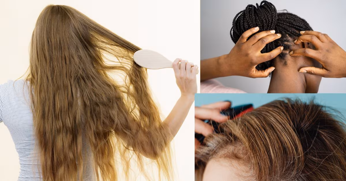 बाल झड़ना और स्कैल्प इंफेक्शन से हैं परेशान? डर्मेटोलॉजिस्ट ने बताए आसान और असरदार उपाय