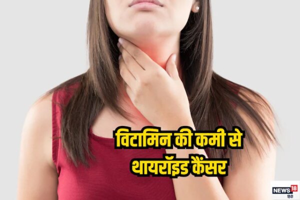शरीर में विटामिन-डी की कमी बढ़ा सकती है थायरॉइड कैंसर का खतरा? एक्सपर्ट ने बताया सच