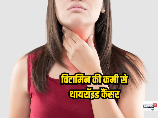 शरीर में विटामिन-डी की कमी बढ़ा सकती है थायरॉइड कैंसर का खतरा? एक्सपर्ट ने बताया सच