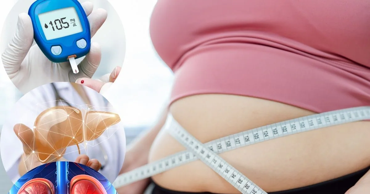 इन 4 बीमारियों की सबसे बड़ी वजह है मोटापा ! धीरे-धीरे पैदा करता है समस्याएं, डॉक्टर ने बताए बचाव के तरीके