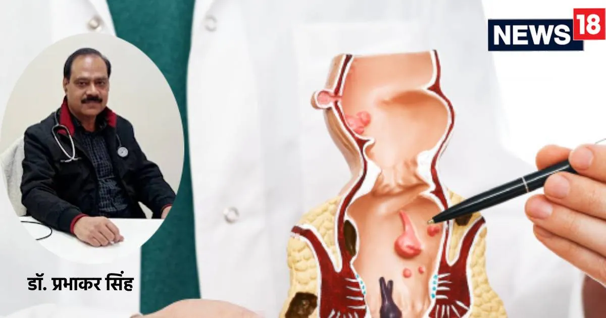 railway lucknow loco pilot piles surgery proof case पाइल्‍स सर्जरी के बाद क‍ितने द‍िन में र‍िकवर होता है मरीज? डॉक्‍टर से जानें