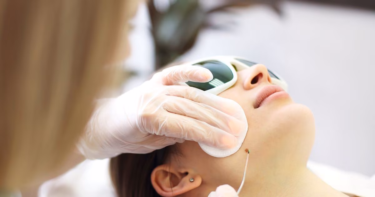 शरीर पर क्यों निकल आते हैं मस्से? क्या है सबसे बड़ी वजह, मस्सों से कैसे मिलेगा छुटकारा, एक्सपर्ट से समझ लीजिए