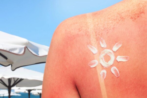 Summer Tips: स्किन जला देने वाली धूप से कैसे बचें? फॉलो करें ये कूलिंग टिप्स