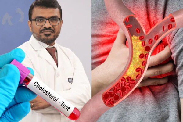 High Cholesterol Symptoms: 20s-30s में हाई कोलेस्ट्रॉल हो रहा कॉमन, इन लक्षणों को नजरअंदाज करना जानलेवा