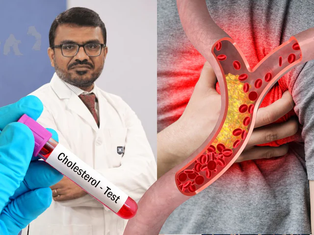High Cholesterol Symptoms: 20s-30s में हाई कोलेस्ट्रॉल हो रहा कॉमन, इन लक्षणों को नजरअंदाज करना जानलेवा