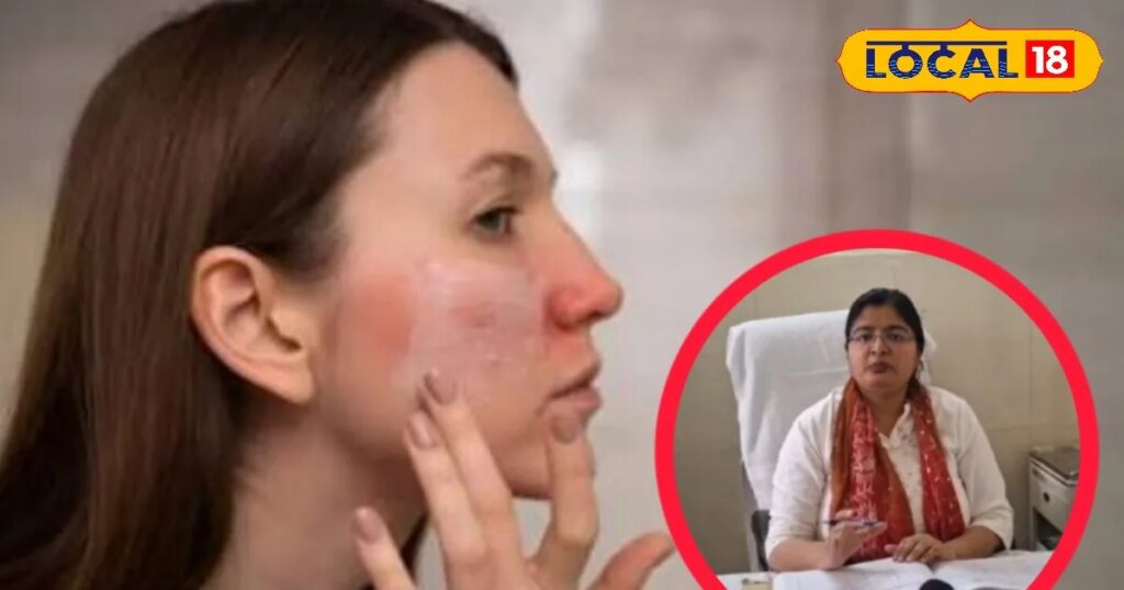 गर्मियों में त्वचा के लिए मुलेठी ज्यादा अच्छी या एलोवेरा जेल? आप भी नहीं जानते होंगे ये वाली ट्रिक गर्मियों में त्वचा के लिए मुलेठी ज्यादा अच्छी या एलोवेरा जेल? आप भी नहीं जानते होंगे ये वाली ट्रिक