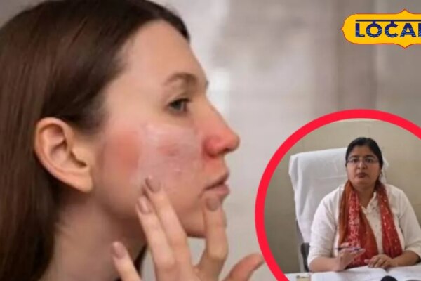 गर्मियों में त्वचा के लिए मुलेठी ज्यादा अच्छी या एलोवेरा जेल? आप भी नहीं जानते होंगे ये वाली ट्रिक