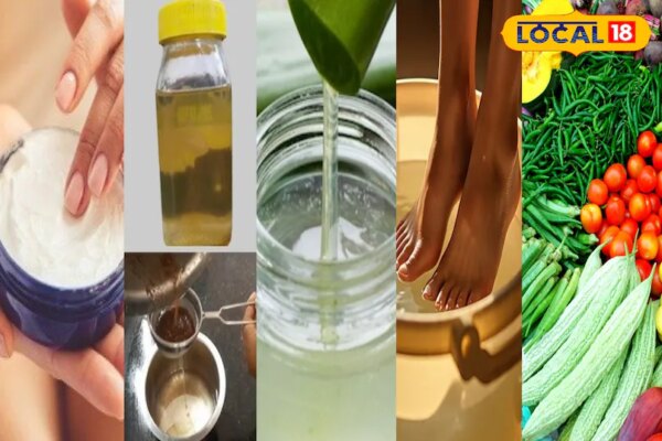 नाखून के किनारों की त्वचा क्यों निकलती है, जानें कारण और घरेलू उपायों से राहत पाने का आसान तरीका