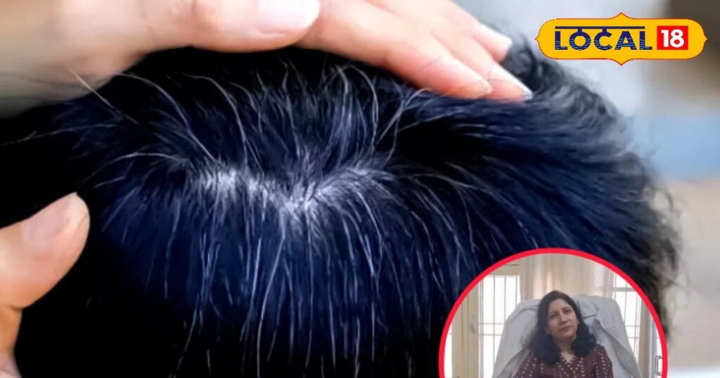 कम उम्र में बाल हो रहे हैं सफेद, तो आयुर्वेदिक डॉक्टर ने जानिए कारण और बचाव के आसान उपाय