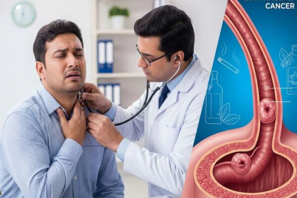 डॉक्टर के पास गया एसिडिटी का इलाज कराने, निकल गया कैंसर, समय रहते बच गई जान, आपके साथ हो ऐसा तो क्या करेंगे