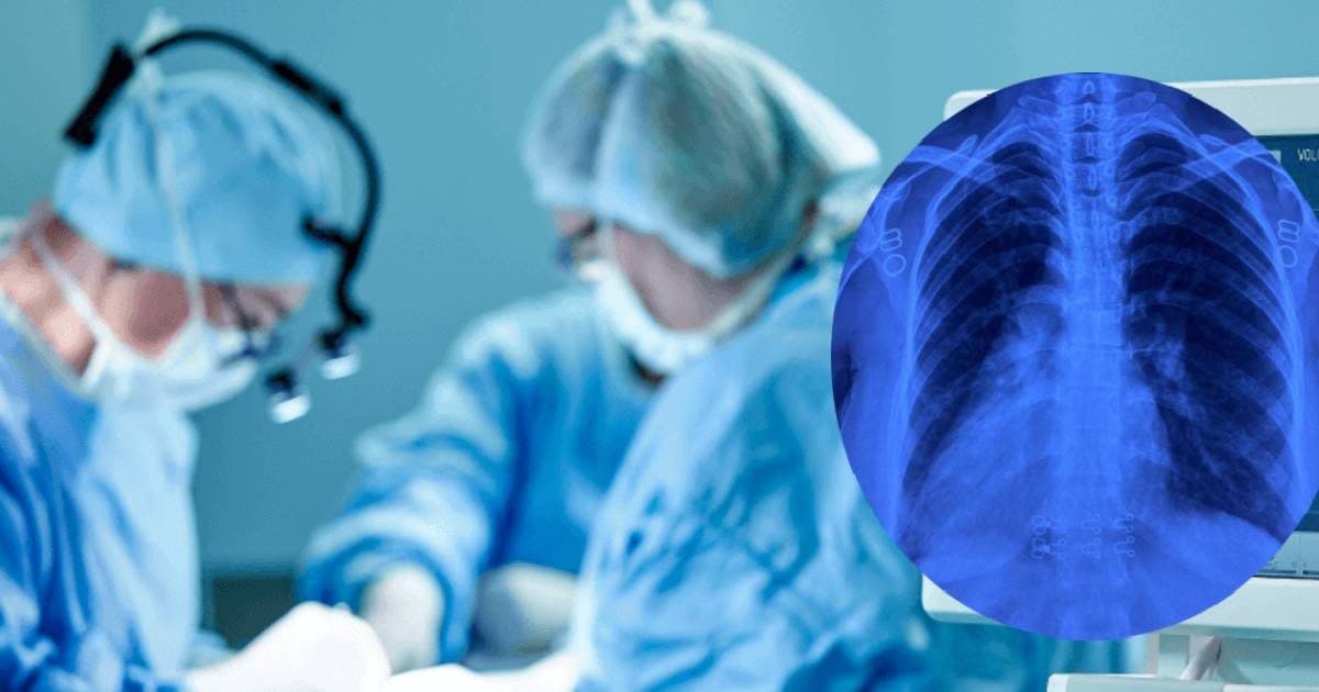 global First heart surgery in RML: न दिल अपनी जगह था न लिवर, RML के डॉक्टरों ने सिर्फ चीरा लगाकर कर दी हार्ट की सर्जरी