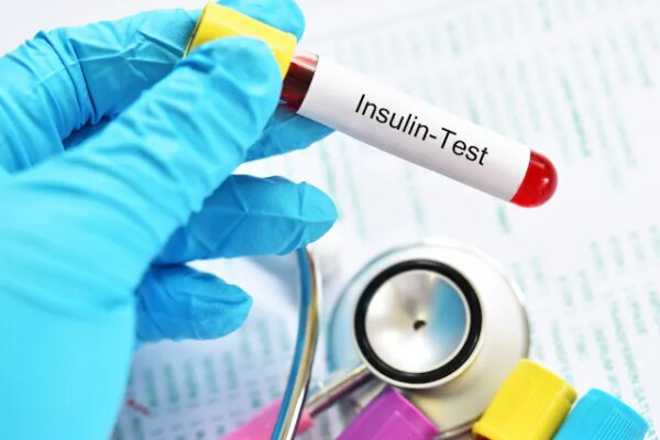 आपके शरीर में इंसुलिन रेजिस्टेंस है या नहीं? पता लगाने के लिए कौन सा टेस्ट कराएं, डॉक्टर से समझिए