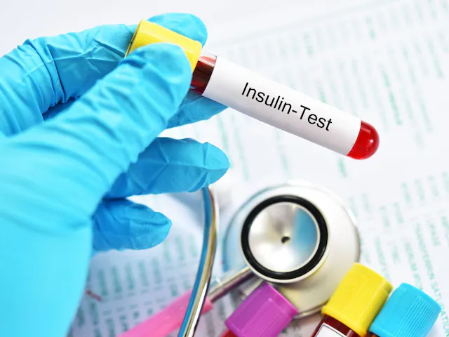 आपके शरीर में इंसुलिन रेजिस्टेंस है या नहीं? पता लगाने के लिए कौन सा टेस्ट कराएं, डॉक्टर से समझिए