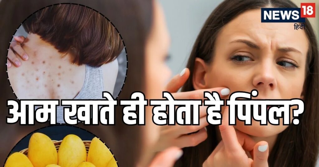 आम खाते ही चेहरे पर क्यों हो जाते हैं मुँहासे? जानें शरीर की गर्मी शांत करने का सही तरीका, चेहरे और पीठ पर नहीं होंगे दाने