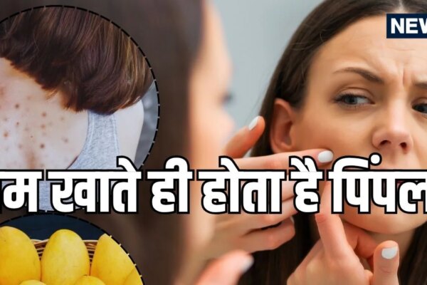 आम खाते ही चेहरे पर क्यों हो जाते हैं मुँहासे? जानें शरीर की गर्मी शांत करने का सही तरीका, चेहरे और पीठ पर नहीं होंगे दाने
