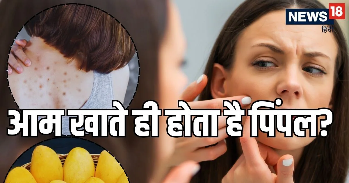 आम खाते ही चेहरे पर क्यों हो जाते हैं मुँहासे? जानें शरीर की गर्मी शांत करने का सही तरीका, चेहरे और पीठ पर नहीं होंगे दाने