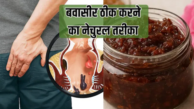 Home Remedies: बिना सर्जरी पाइल्स ठीक करने का नेचुरल तरीका