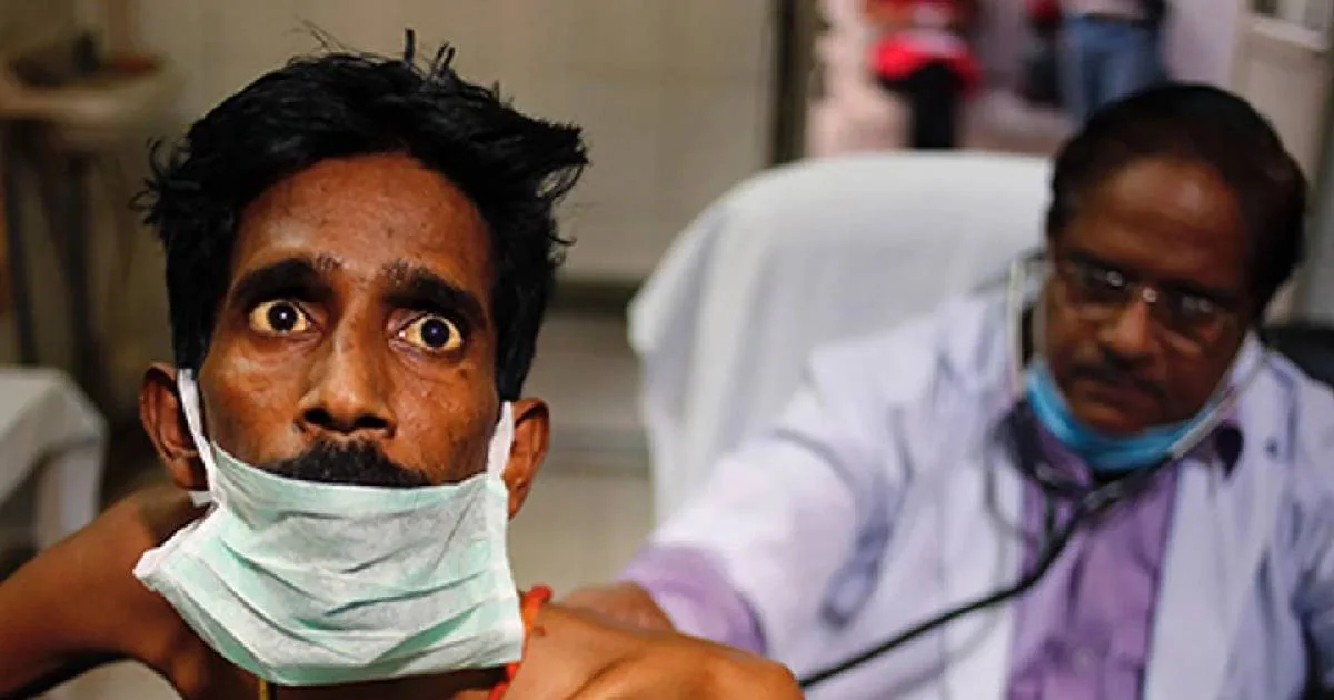 Delhi TB outbreak| delhi TB patient| TB in delhi| दिल्ली में टीबी विस्फोट! डेढ़ महीने में मिले 12 हजार मरीज, अभी और कितने?
