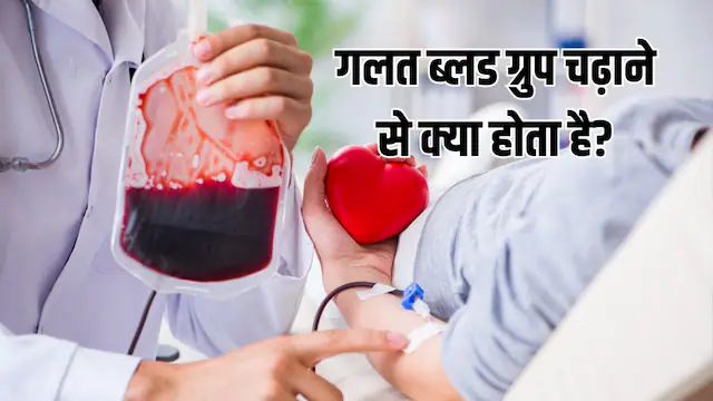 गलत ब्लड ग्रुप चढ़ाने से क्या होता है? O+ की जगह अगर B+ ब्लड चढ़ा दें तो क्या नुकसान हो सकते हैं, डॉ. से जानें