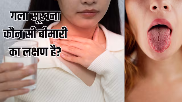 गर्मी में बार-बार गला सूखना, नॉर्मल या किस बीमारी का संकेत? ENT एक्सपर्ट ने दी ये चेतावनी