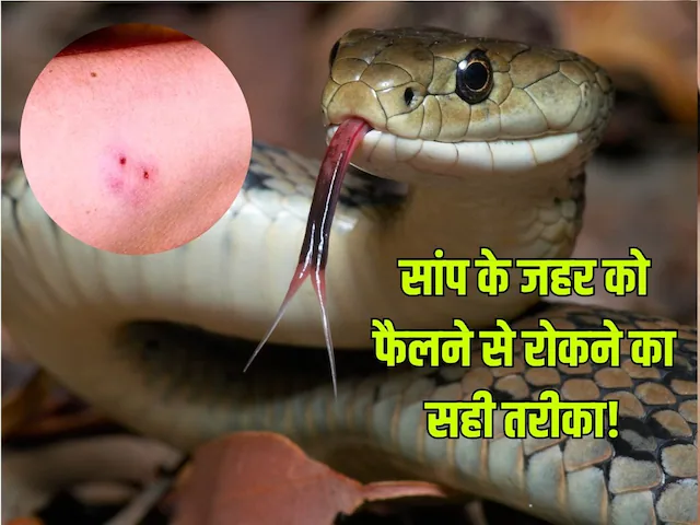 First Aid For A Snakebite: सांप के काटने पर जहर को शरीर में फैलने से रोकने का उपाय