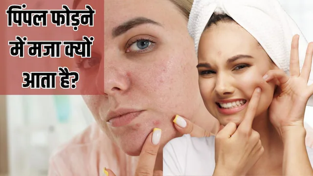 बार-बार पिंपल को छूने से नहीं रोक पाते? दिमाग खेल रहा खेल, जानें साइकोलॉजिकल वजह